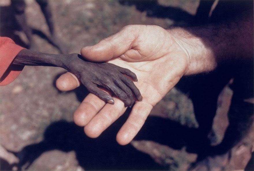 A 1980 photo by Mike Wells, showing a severely malnourished Uganda boy’s hand rests in a Catholic monk’s hand.
